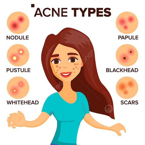 Acne Types Png Vector Psd And Clipart With Transparent Background