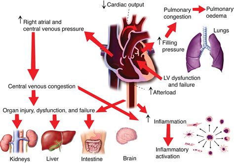 Organ Dysfunction Injury And Failure In Acute Heart Failure From