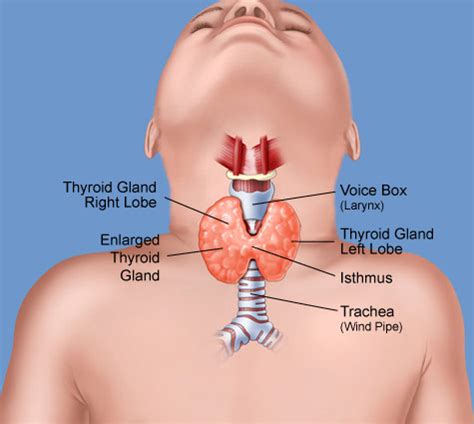 Covid vaccine researchers had previously assumed mrna covid vaccines would behave like traditional vaccines. Symptoms of Thyroid Problems | Med-Health.net