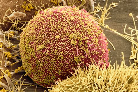 For people with hiv, if you have been taking effective hiv treatment and your viral load has been undetectable. HIV defies attempt to edit virus out of human cells with CRISPR | New Scientist