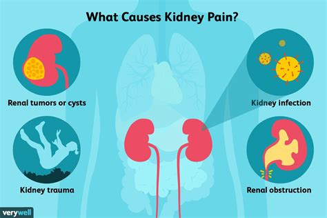Kidney Infections Symptoms