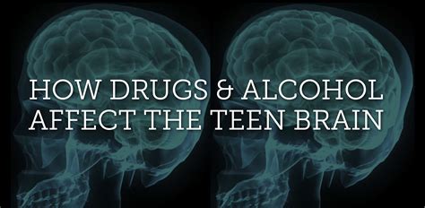 Teen Alcohol And Brain Development