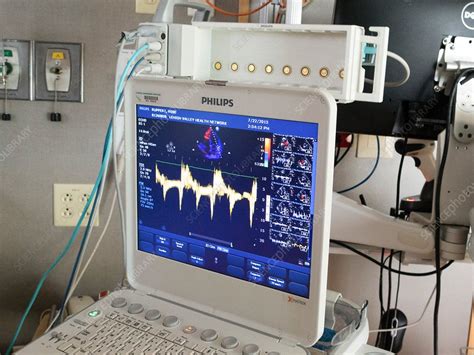 Cardiac Ultrasound Scanner Stock Image C0298897 Science Photo