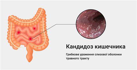 Мед при лечении кандидоз кишечника Картинка - Мед при лечении кандидоз кишечника