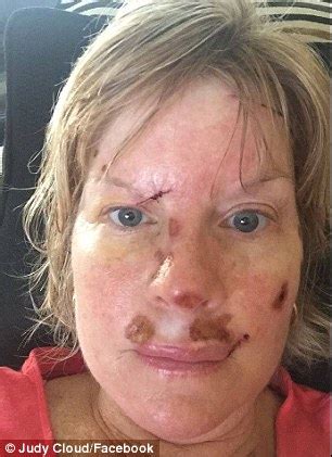 She wants you to show how into her you are with compliments, romantic dates, and solid communication. THIS is what skin cancer looks like: Woman shows damaging ...