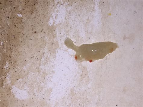 Roter schleim im stuhl ist der schleimige stuhlgang rot eingefärbt, können zum beispiel rote lebensmittel die ursache dafür sein. Wie ernstzunehmend ist das? (Gesundheit, Arzt, Blut)