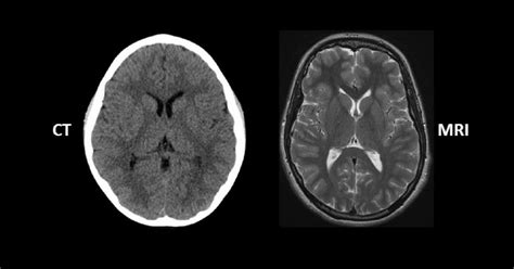 Ct Scan Vs MRI Important Things To Know For A Patient