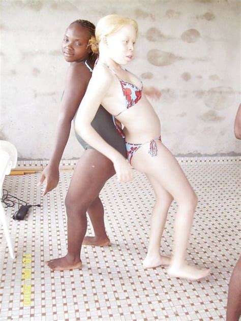 Hot Albino Girls Nude