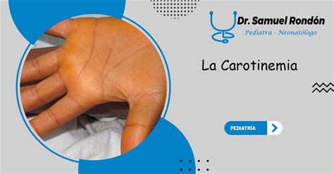 La Carotinemia Piel Amarilla Sin Ictericia Dr Samuel Rondon