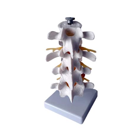 Buy Xiezi Anatomical Model Anatomical Human Spine Lumbar Vertebrae Degenerative Lumbar Disc
