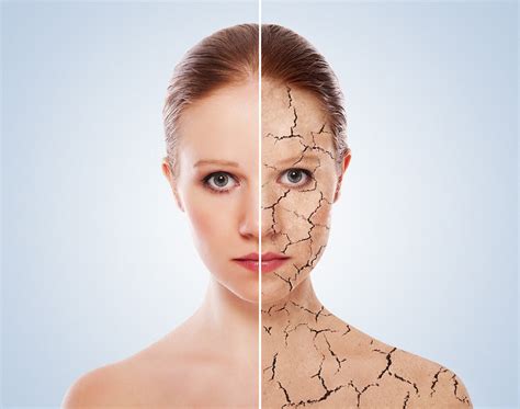 Home Remedies For Dry Patches On Face Fair And Flawless