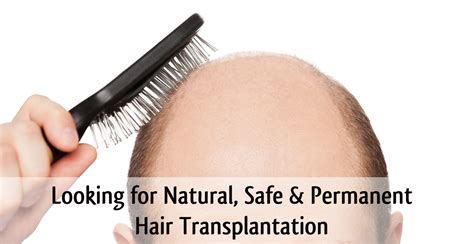 Benefits Of Fue Hair Transplant Hairtransplantdelhi