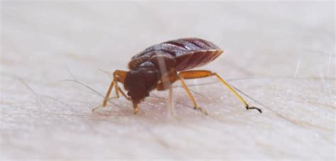 Do Bed Bug Bites Hurt Everything You Need To Know Pestseek