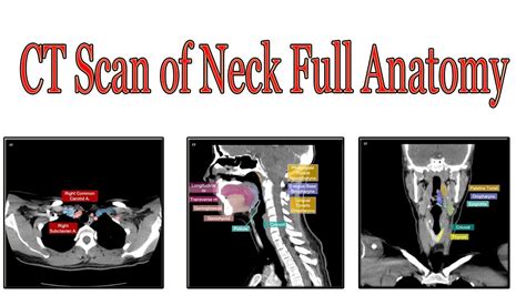 Ct Scan Of Neck Axial Full Anatomy Youtube
