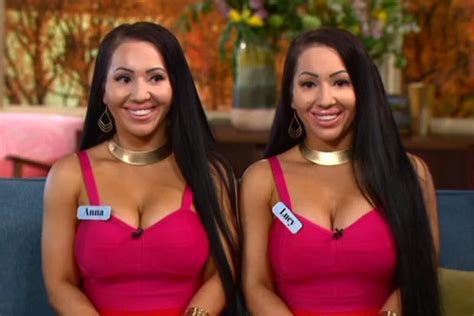 The Worlds Most Identical Twins Are Back Much To This Morning Viewers