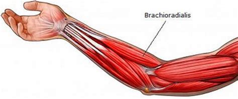 In the forearm they make your wrist move up or down (like the movement you this pictures shows what a colles' fracture looks like from the outside Brachioradialis Pain and Treatment