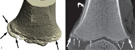 Lower extremity trauma | Radiology Key