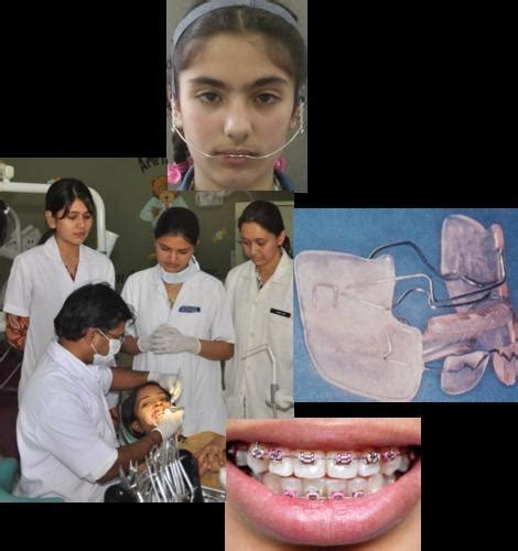 Orthodontics At Best Price In Ahmedabad By Ahmadabad Dental College