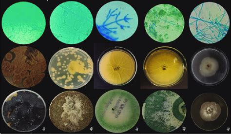 Characteristics Of Filamentous Fungal Species From Left To Right On