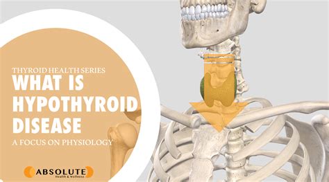 What Is Hypothyroid Disease Absolute Health And Wellness