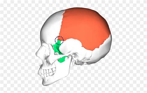 Position Of Sphenoparietal Suture Sutura Sphenozygomatic Free