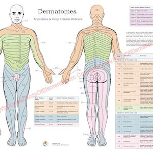 Dermatomes Myotomes And DTR Nervous System Poster 18 X 24 Chiropractic