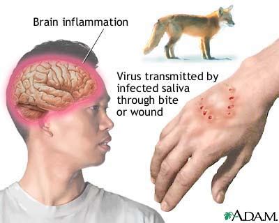 The signs, symptoms, and outcome of rabies in animals can vary, but are often similar to those in humans, including early nonspecific symptoms, acute neurologic. Diseases-causes&cure: 7 th Bizarre Killer Diseases ...