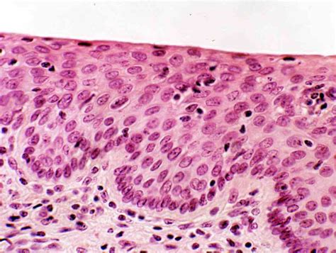 Cells Of Epithelial Tissue