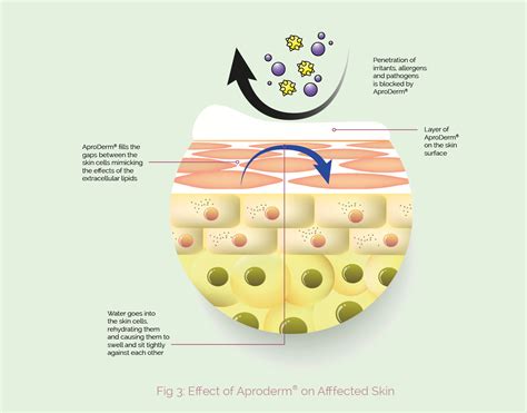 Affect On Skin What Is Aproderm