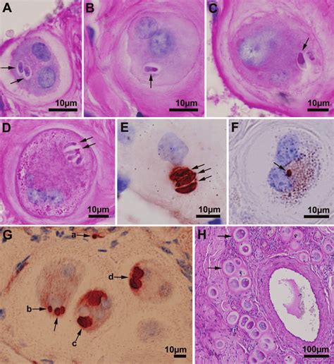 Development Of Besnoitia Besnoiti Tissue Cysts In Histological Sections