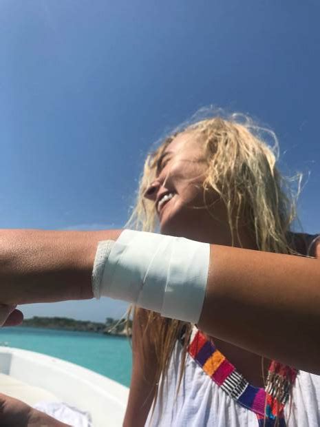 California Instagram Models Shark Bite Moment Goes Viral But Was It