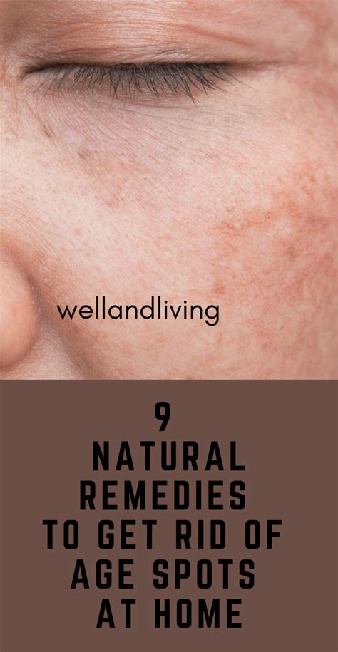 9 Easy Natural Remedies To Get Rid Of Age Spots At Home Well And Living