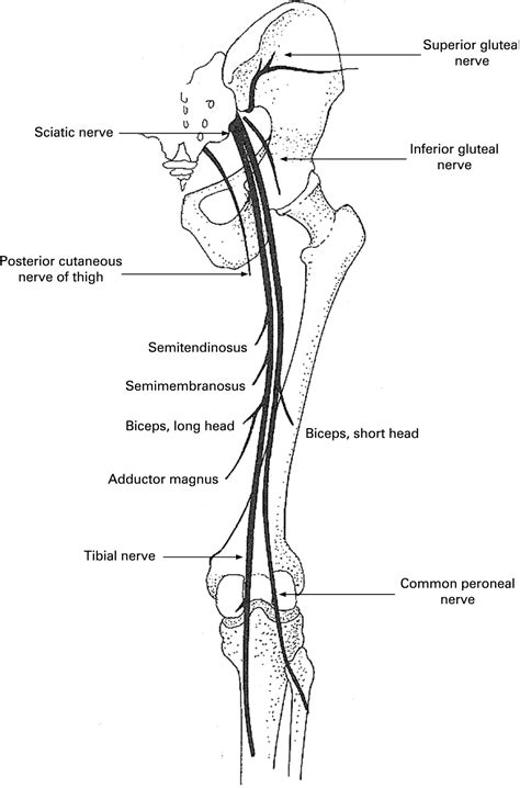 The sciatic nerve is the largest peripheral nerve in the body, and extends from the lower end of the spinal cord, through the thigh a review lecture on sciatic nerve that helps you understand it better by covering its origin, course, relations, branches, termination. Foot drop: where, why and what to do? | Practical Neurology