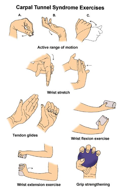 Carpal Tunnel Syndrome Reliva Physiotherapy And Rehab