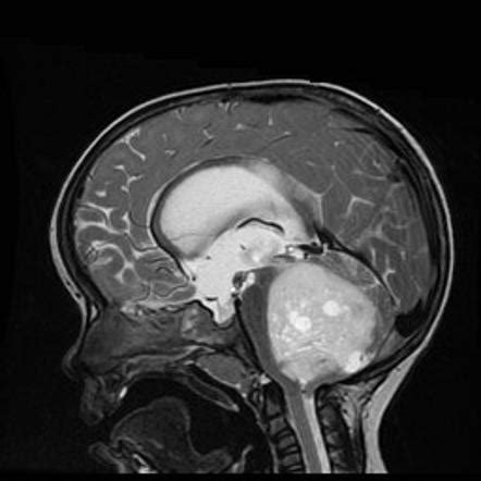Image | Radiopaedia.org