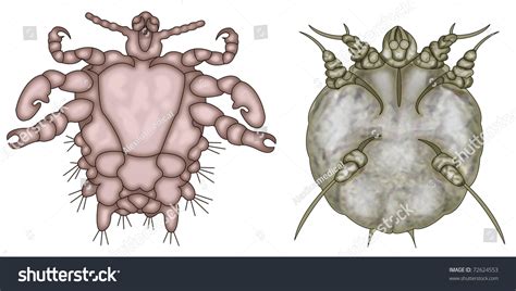 Illustration Two Parasites Belonging Human Scalp Stock Illustration