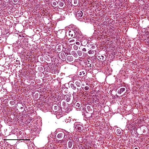 We did not find results for: Lung parenchyma with morula stage structures, eggs and ...