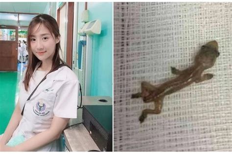  teks lagu cicak atau jika memungkinkan alat audio agar ciri cirri makhluk hidup kegiatan pada gambar. Viral di Facebook, Seorang Dokter Muda Terkejut Temukan ...