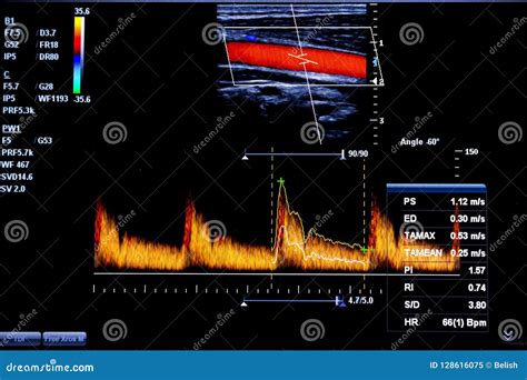 Colourful Image Of Modern Ultrasound Monitor Editorial Image Image Of