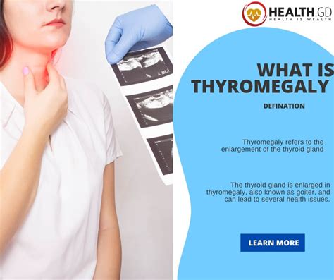 What Is Thyromegaly And How To Treat It Healthgd