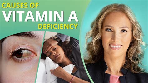 Vitamin A Symptoms Of Vitamin A Deficiency Dr J Live Youtube