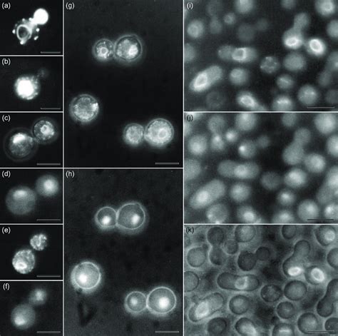 Fluorescent Microscopy Of Cryptococcus Neoformans A And B C Download Scientific Diagram