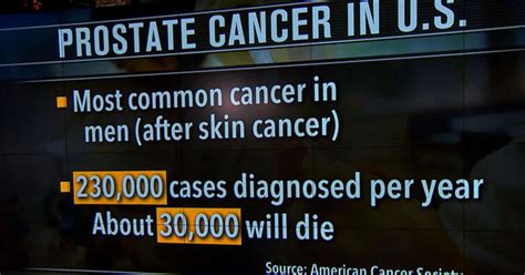 Breakthroughs In Prostate Cancer Treatment CBS News