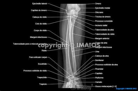 Radiologia Radio E Ulna