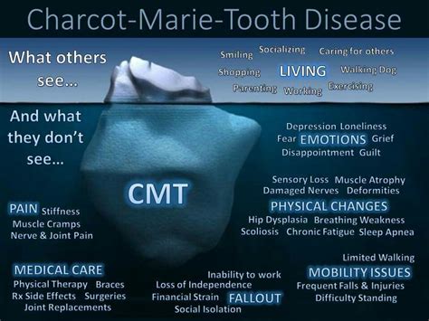 Although the conservative intervention is the only treatment for the disease, there is no scientific evidence so far on rehabilitation treatment. Charcot marie tooth | Teeth diseases, Muscle atrophy, Cmt