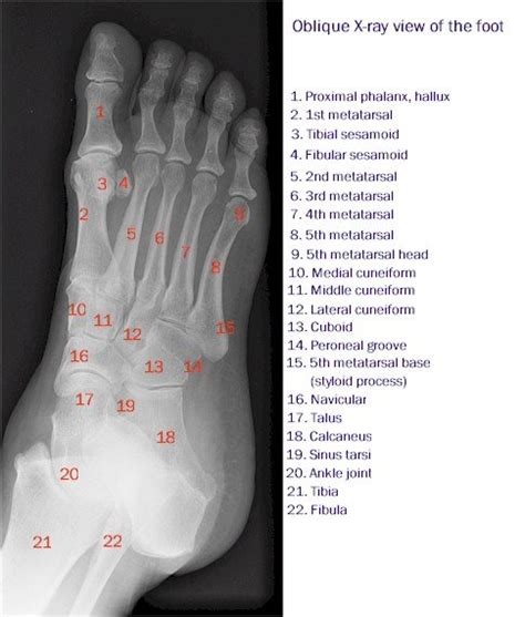 X Ray Of The Foot Oblique View