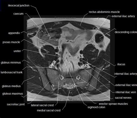 The muscles of the pelvis, hip and buttock anatomical chart shows how each muscle in this area of the body works with the others, and the various minor systems within the major ones. MRI pelvis anatomy | free male pelvis axial anatomy