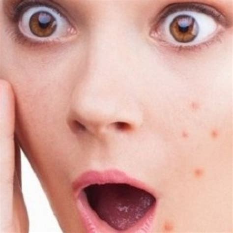 Biodata iwan fals profil agama foto instagram terbaru ven gian via vengian.blogspot.com. Cara Menghilangkan Bintik Hitam Di Wajah Dengan Bahan Alami - Menghilangkan Masalah