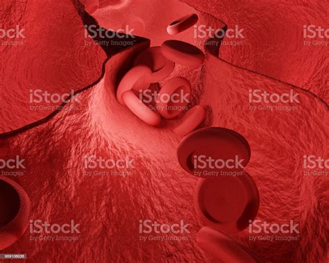 Constricted Blood Vessels Coronary Heart Disease 3d Rendering Stock
