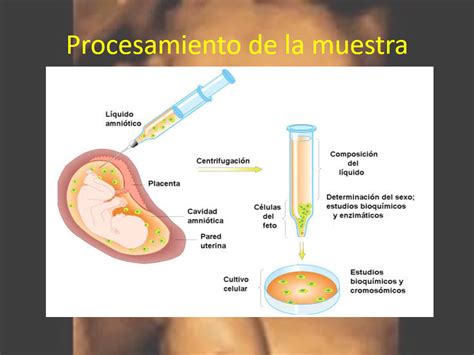 Cursada De Obstetricia Hospital Rivadavia Uba Diagnóstico Prenatal